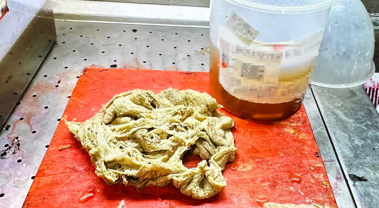 D O G U M D A U N U T U L D U G U 2 Y I L S O N R A O R T A Y A C I 877654 260742