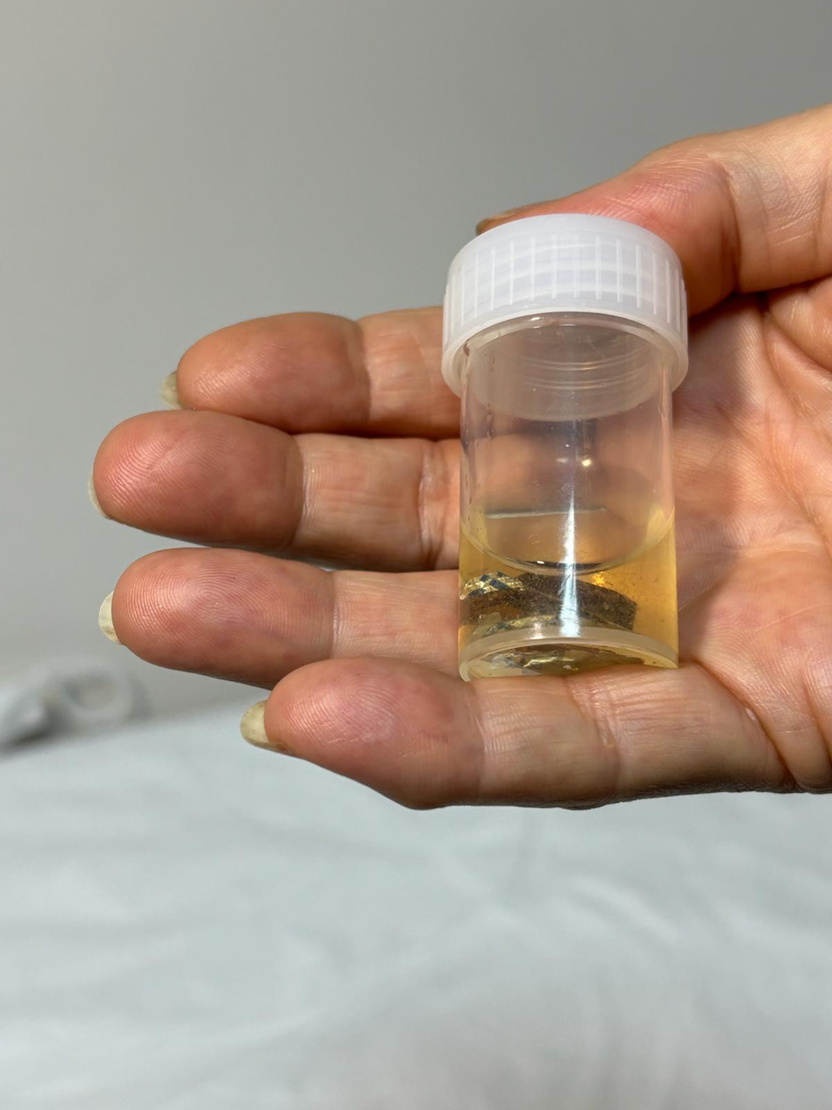 A L U M I N Y U M K A B I Y L A Y U T T U G U H A P 4 Y I L S O N 1070167 317566