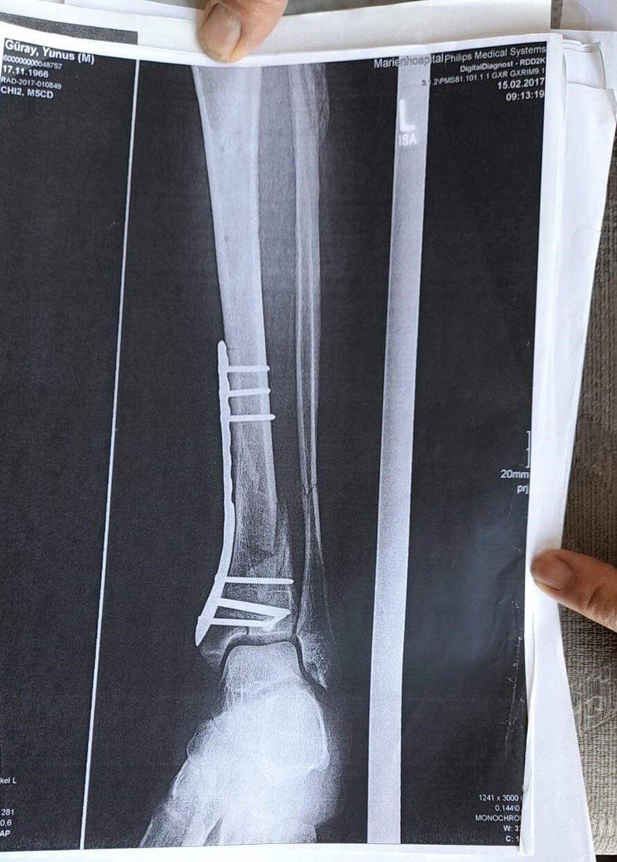 A R K E O L O J I K K A Z I A L A N I N D A K I C U K U R A D U S U N C 1219796 362732