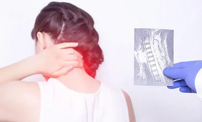 Osteoporoz