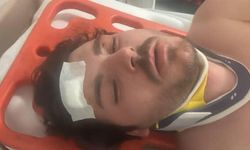 Saldırıya uğrayan genç oyuncu o anları anlattı