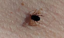 Kenenin ısırdığı adam kurtarılamadı