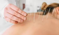Aile hekimlerinden akupunktur hizmeti