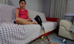 Özge'nin protezi Türkiye'yi ayağa kaldırdı