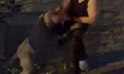 Pitbull cinsi köpek sahibine saldırdı