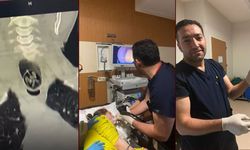 Yuttuğu ceviz yemek borusundan çıkarıldı