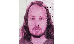 Saç ekimi ve diş tedavisinin ardından hayatını kaybetti