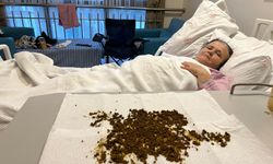 Safra kesesinden 20 binden fazla taş çıktı