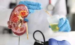 Antalya'da böbrek sağlığı masaya yatırılacak