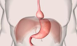 ‘Reflü şikayetleri mide fıtığının habercisi olabilir’