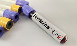 Hantavirüs nedir, nasıl korunulur?