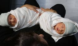 Milyonda bir görülen doğum olayı