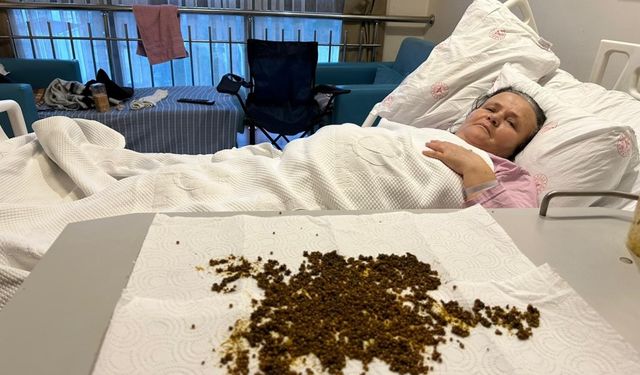 Safra kesesinden 20 binden fazla taş çıktı