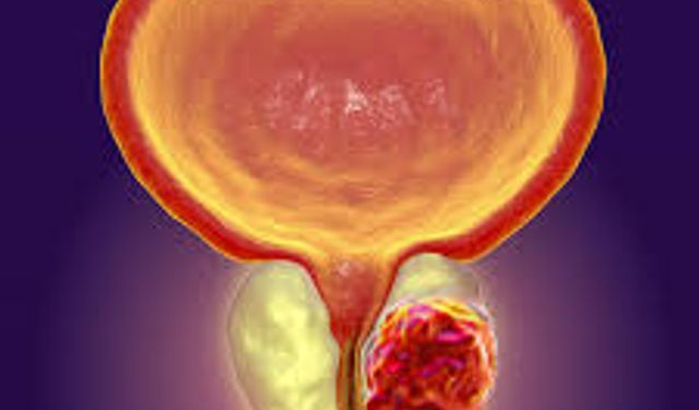 Prostat kanserine özel akıllı görüntüleme