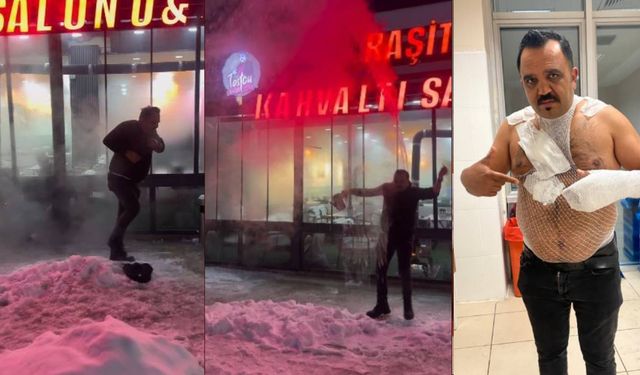 Şov yapmak isterken kendini yaktı