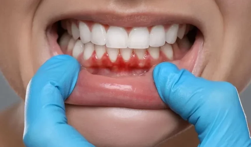 Ağızdaki gizli tehlike