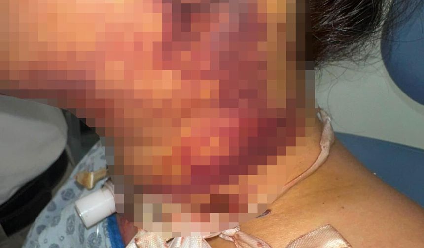Estetik operasyon kabusa döndü: 5 milyon TL’lik dava